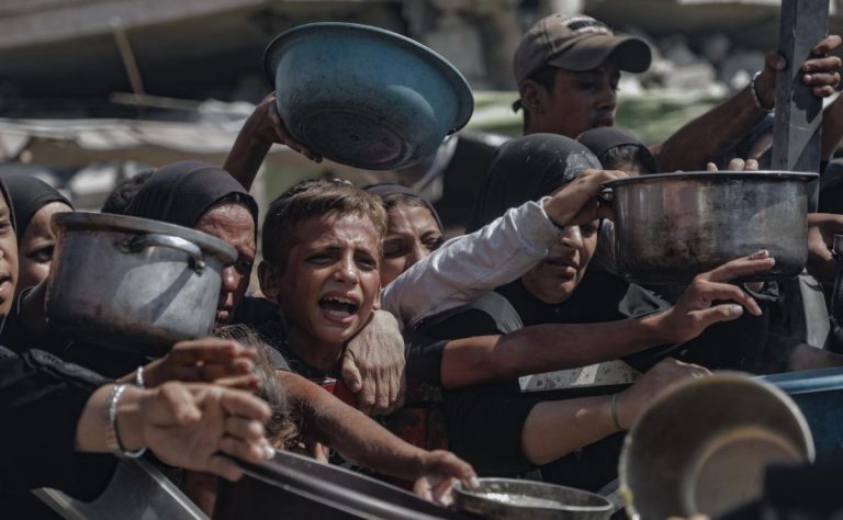 victimas-de-hambruna-en-la-franja-de-gaza